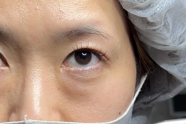 上向きテスト後