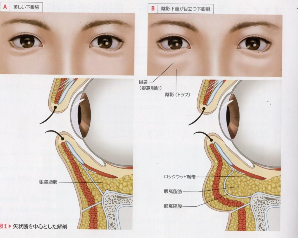 顔の美容外科手術