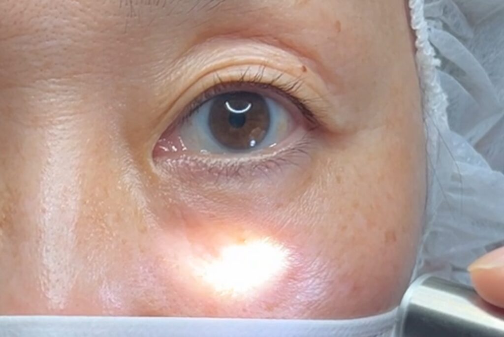 下からのライトテスト（凹凸の確認）