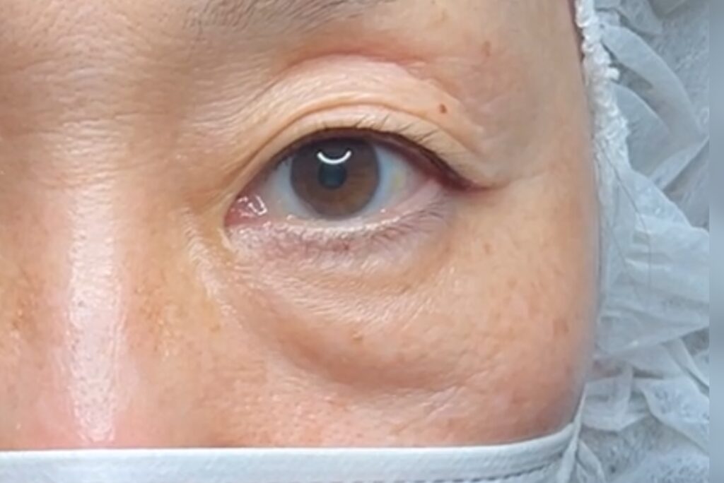 下からのライトテスト（凹凸の確認）