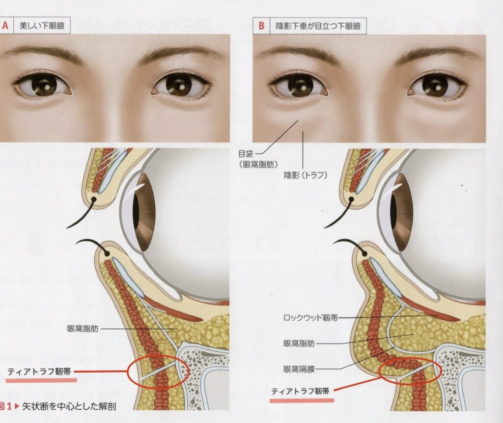 顔の美容外科手術