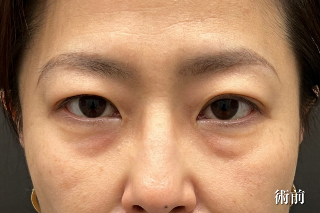 経過写真(術前)