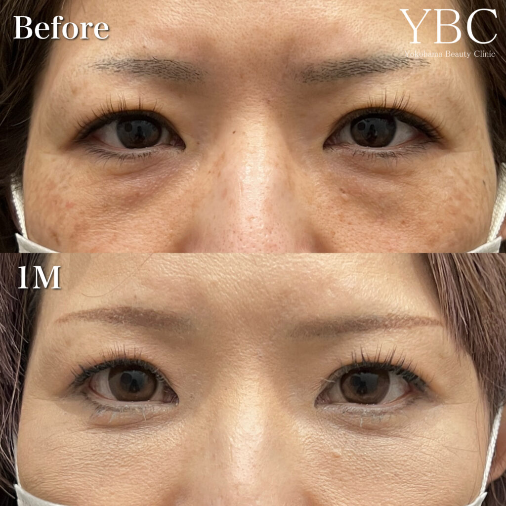40代のクマ