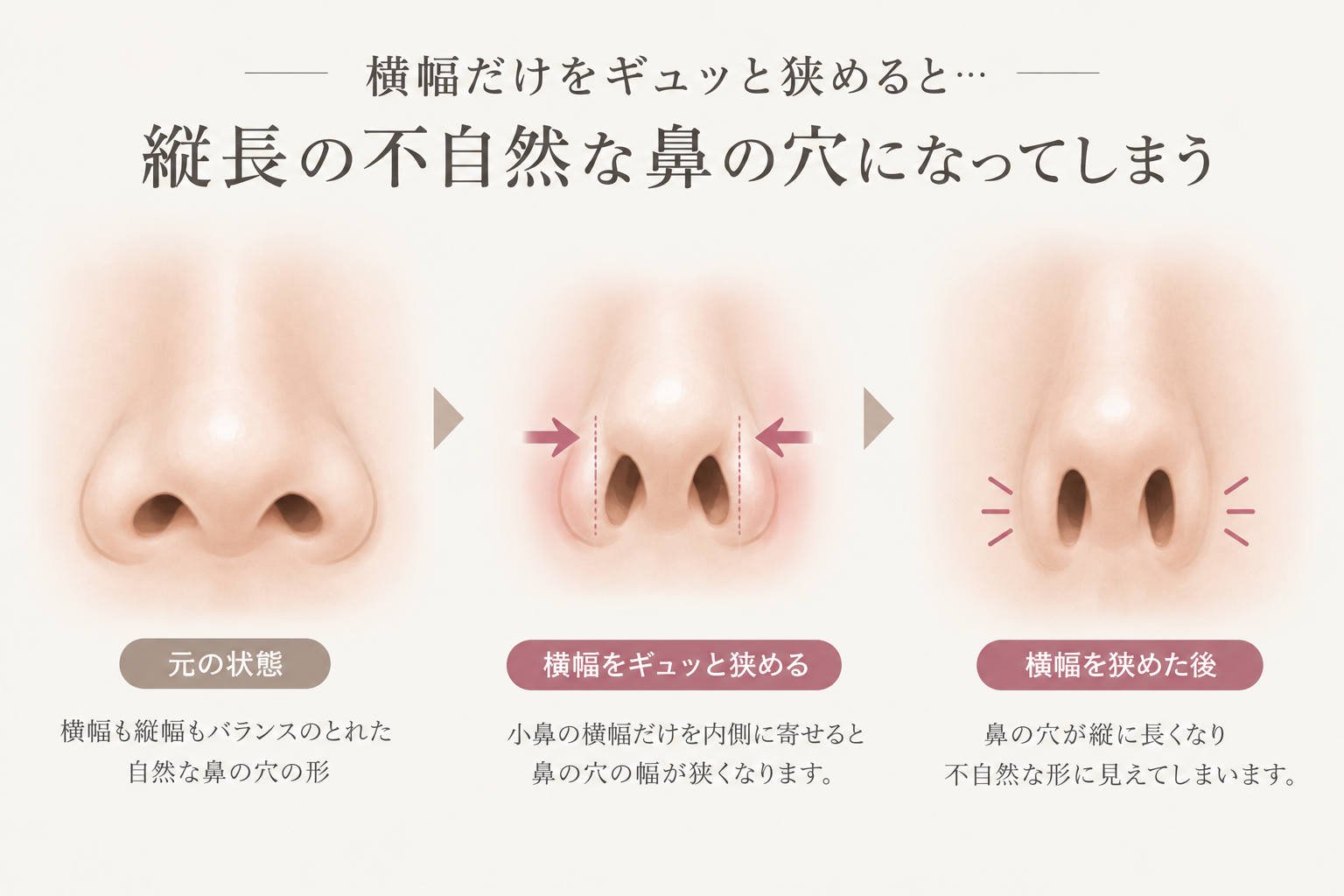 縦長の不自然な鼻になってしまう事の説明