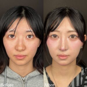 症例画像