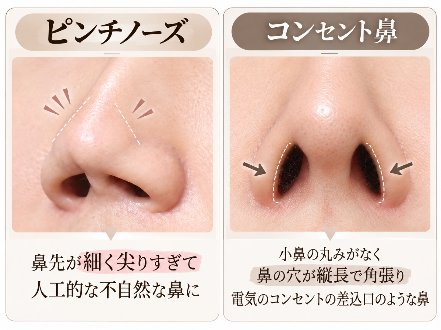 ピンチノーズとコンセント鼻の説明