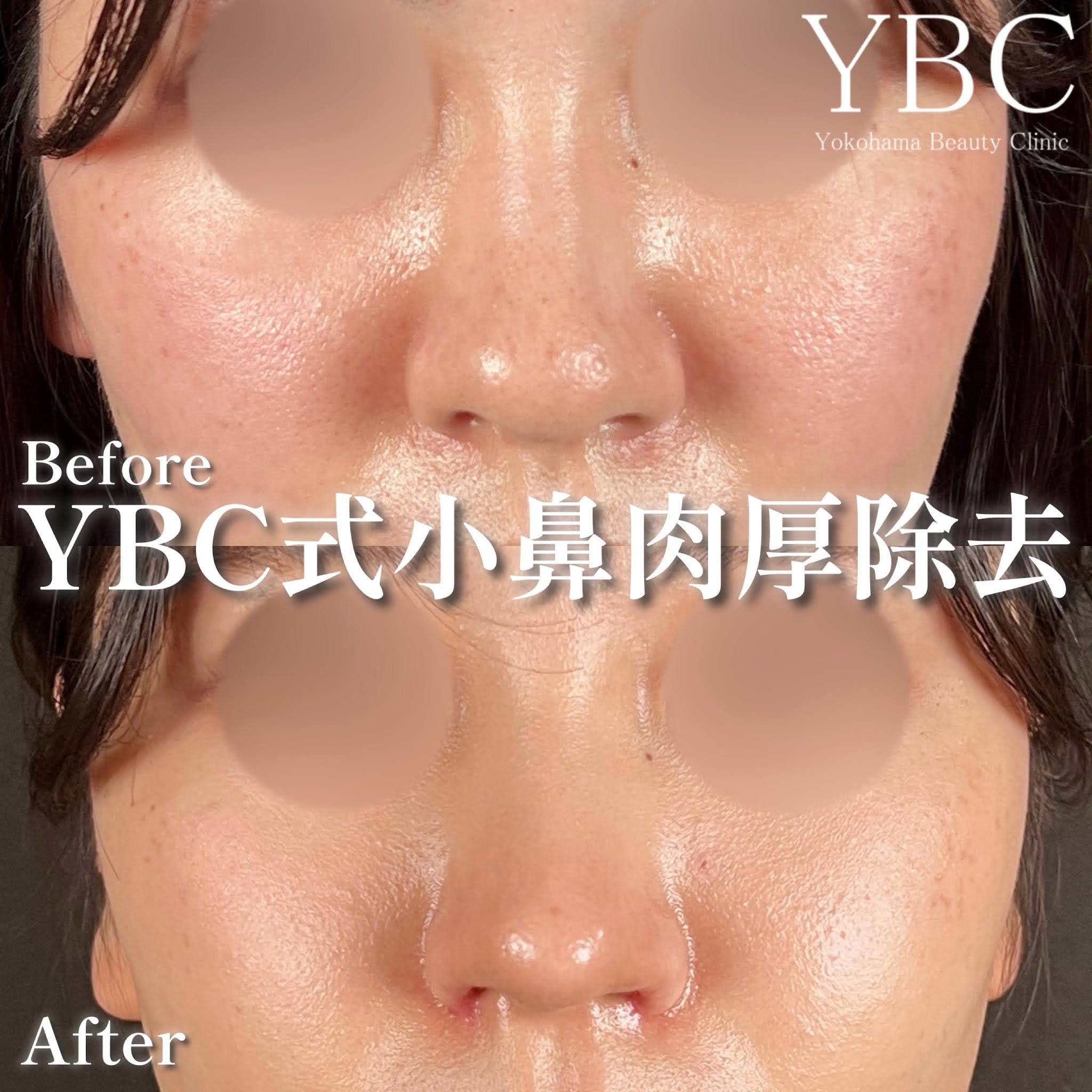 症例画像